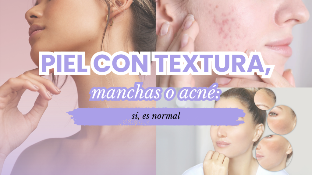 Piel con textura, manchas o acné sí, es normal