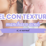 Piel con textura, manchas o acné sí, es normal